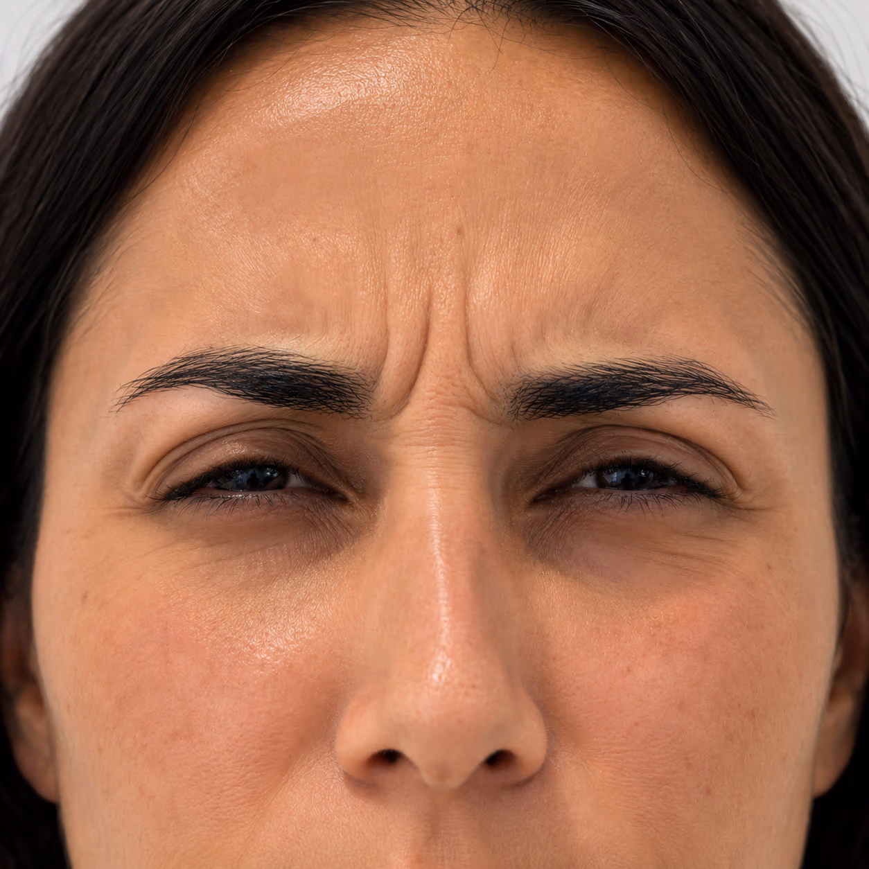 Antes del tratamiento — Rostro